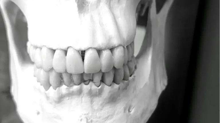 How to Make the Most of Your Visit to an Orthodontist in Brandon, FL