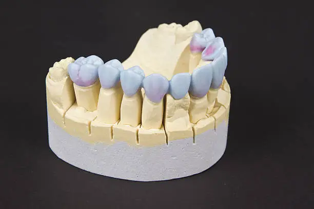 What is Dental Wax & How to Use It?
