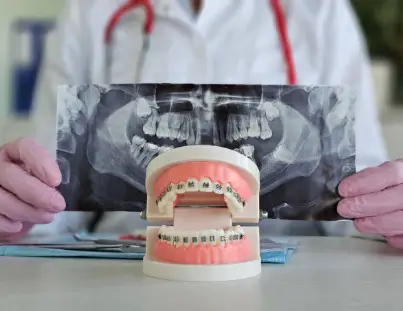 3 Ways to Find an Orthodontist!
