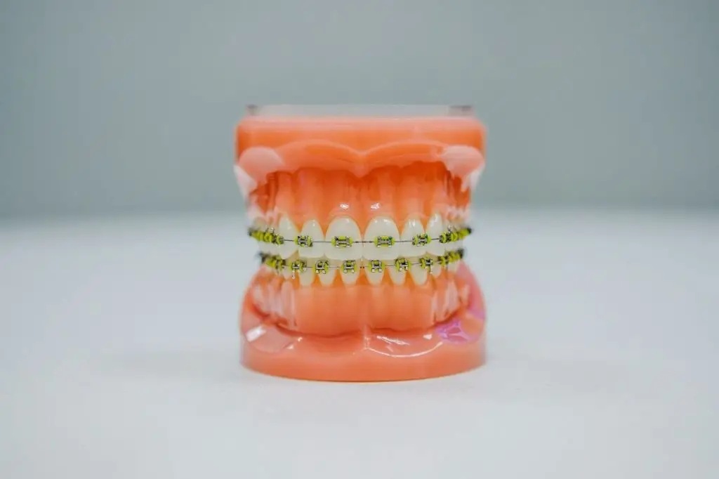 See your dentist when you observe swelling, bleeding gums, or persisting lousy breath