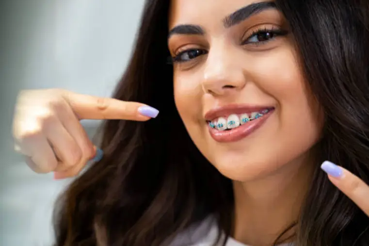 Spacers in Orthodontics