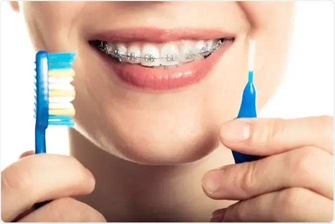 Oral Care as a crucial part of braces treatment