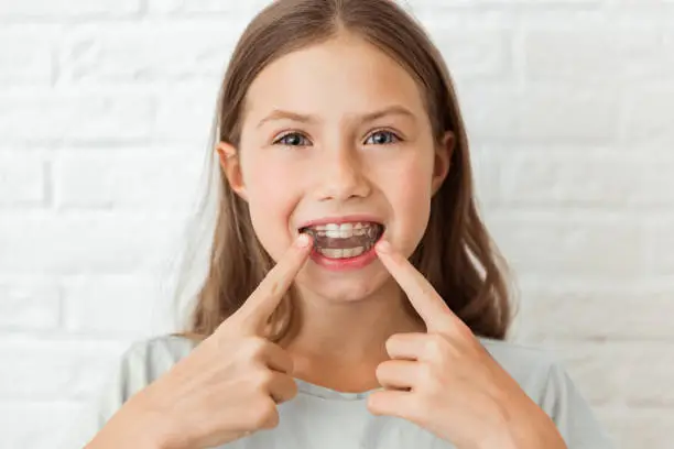 Foods to Avoid With Braces