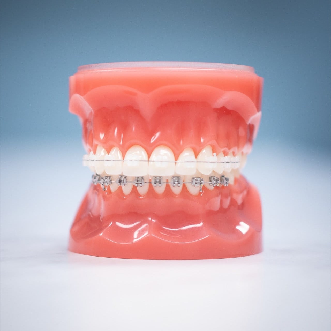 Orthodontics Model with Ceramic and Metal Brackets Teach Model