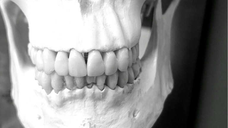 How to Make the Most of Your Visit to an Orthodontist in Brandon, FL