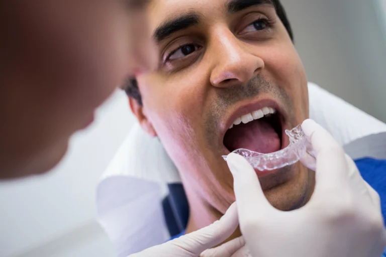 How Long Does Invisalign Take To Straighten Teeth?