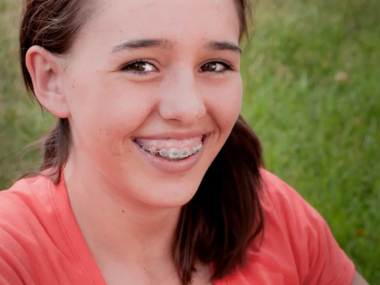 Braces for Adults: Is It Too Late for a Perfect Smile?