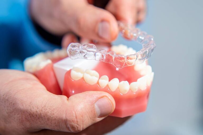 Is Invisalign Worth It? (Pros, Cons & Cost for Adults & Teens)