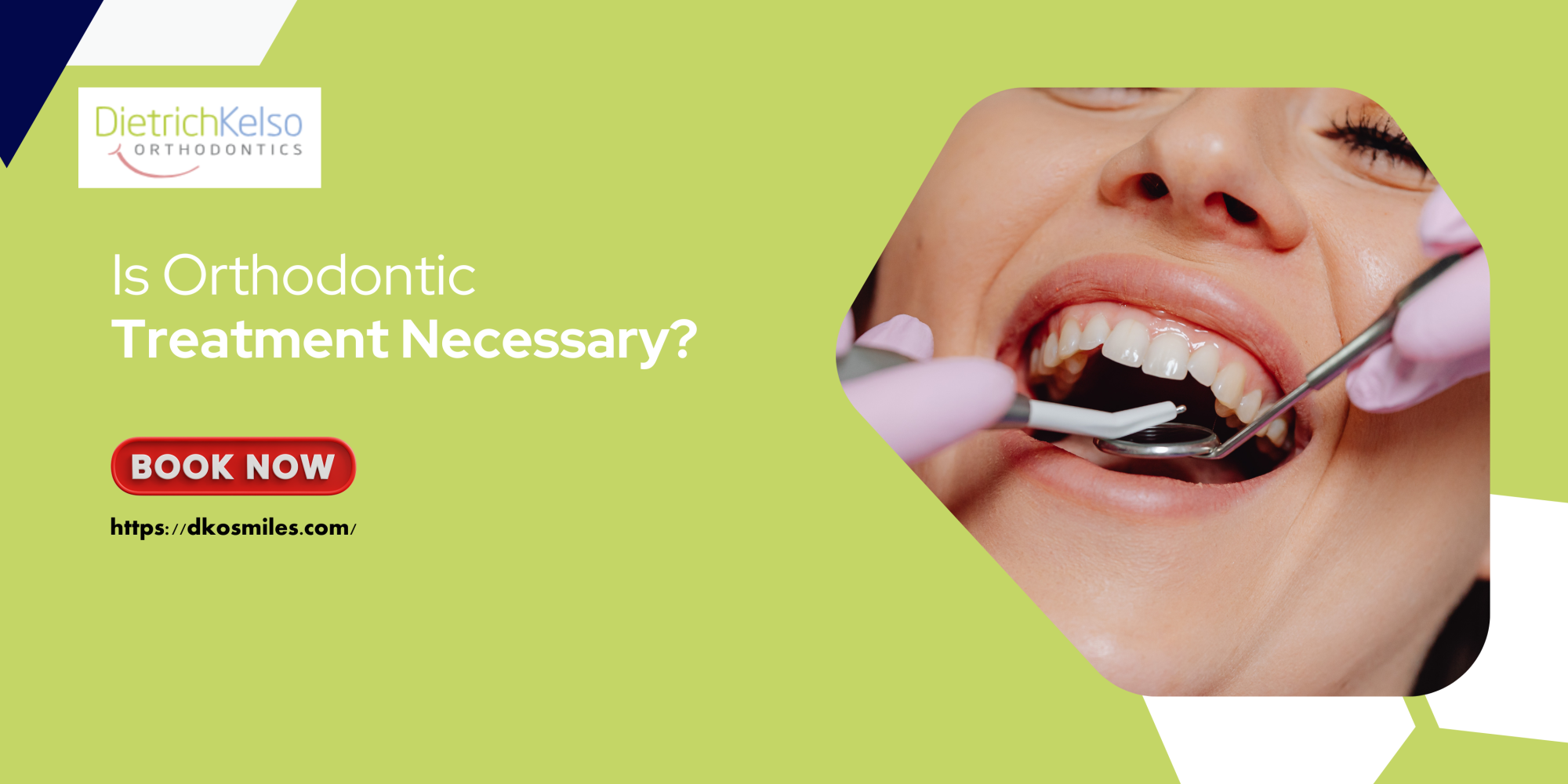 Is Orthodontic Treatment Necessary?