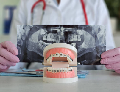 3 Ways to Find an Orthodontist!