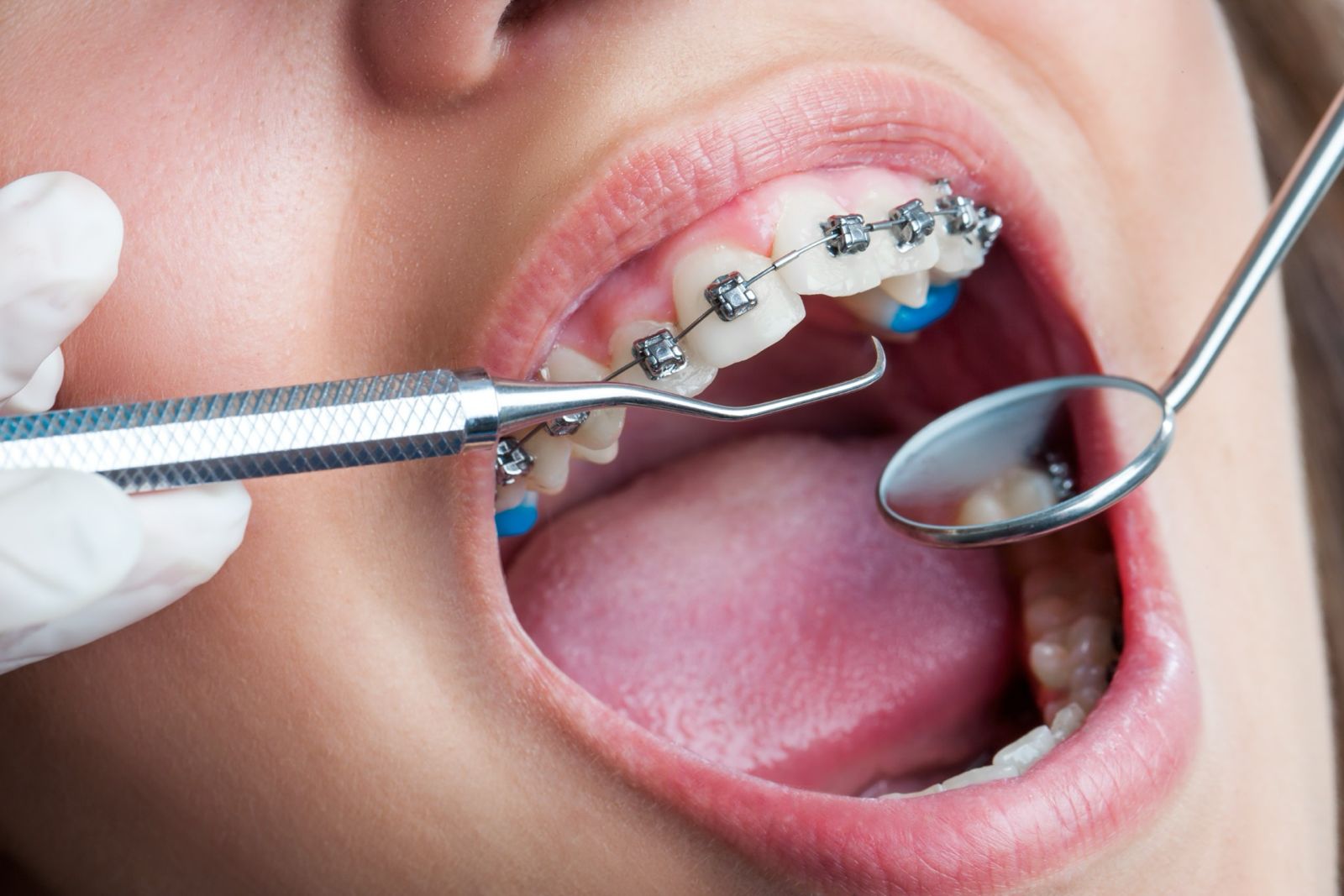 Dental Checkup being done by Dr. Ken