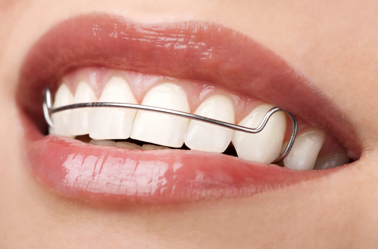 Reliable Orthodontic Care in Riverview?