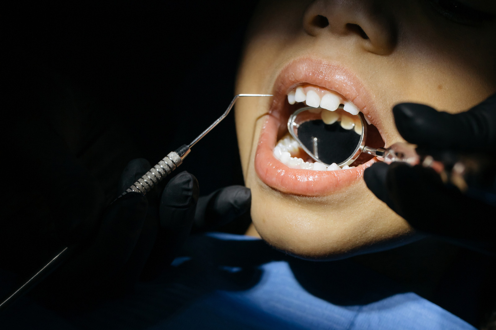 Can Invisalign Fix Overbites and Crooked Teeth in Lakeland?