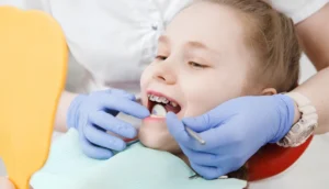 Common Bite Problems Treated with Braces in Palm Harbor