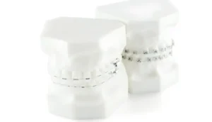 Does Insurance Cover Braces or Invisalign in Florida?