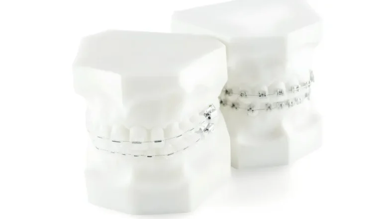 Does Insurance Cover Braces or Invisalign in Florida?