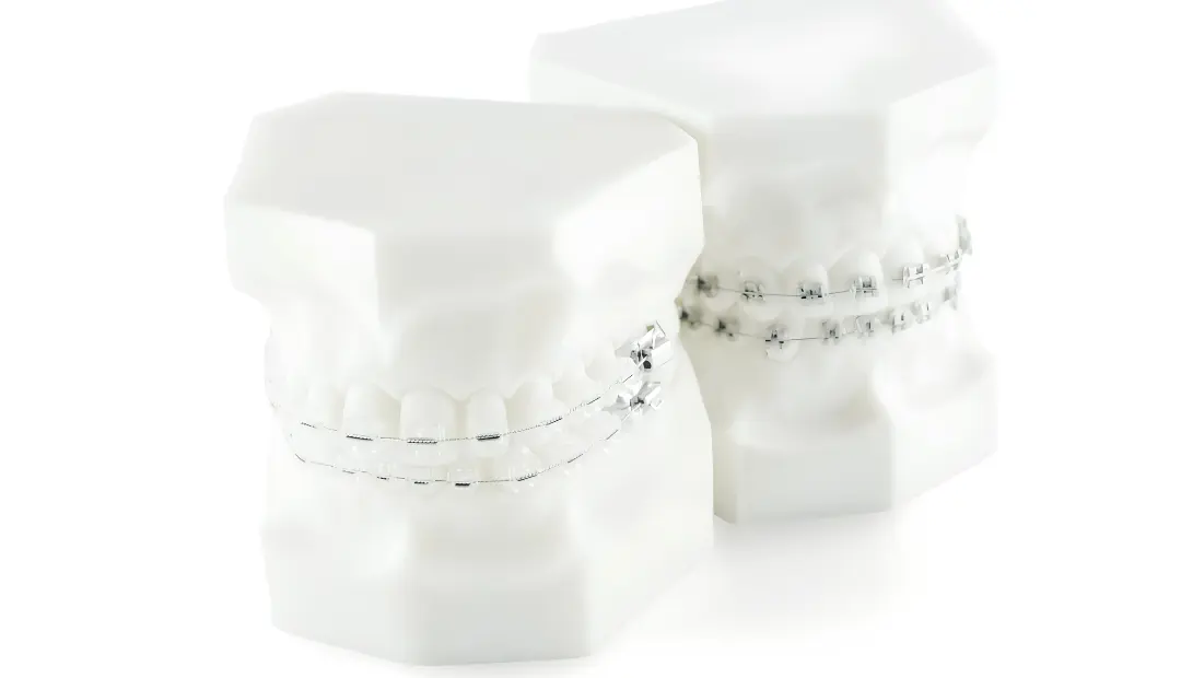 Does Insurance Cover Braces or Invisalign in Florida?